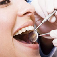 Root Canal Treatment in Chennai